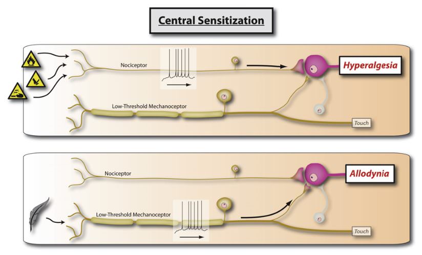 中樞敏感化時的神經傳導路徑