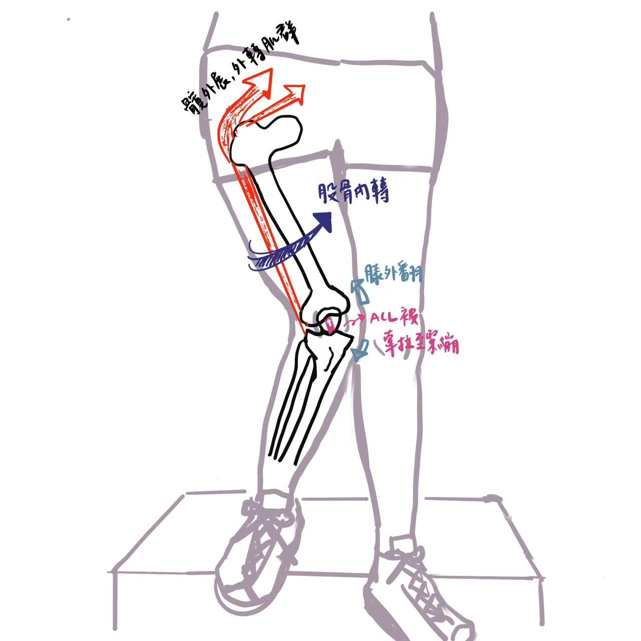 圖1、臀肌無力導致前十字韌帶額外壓力