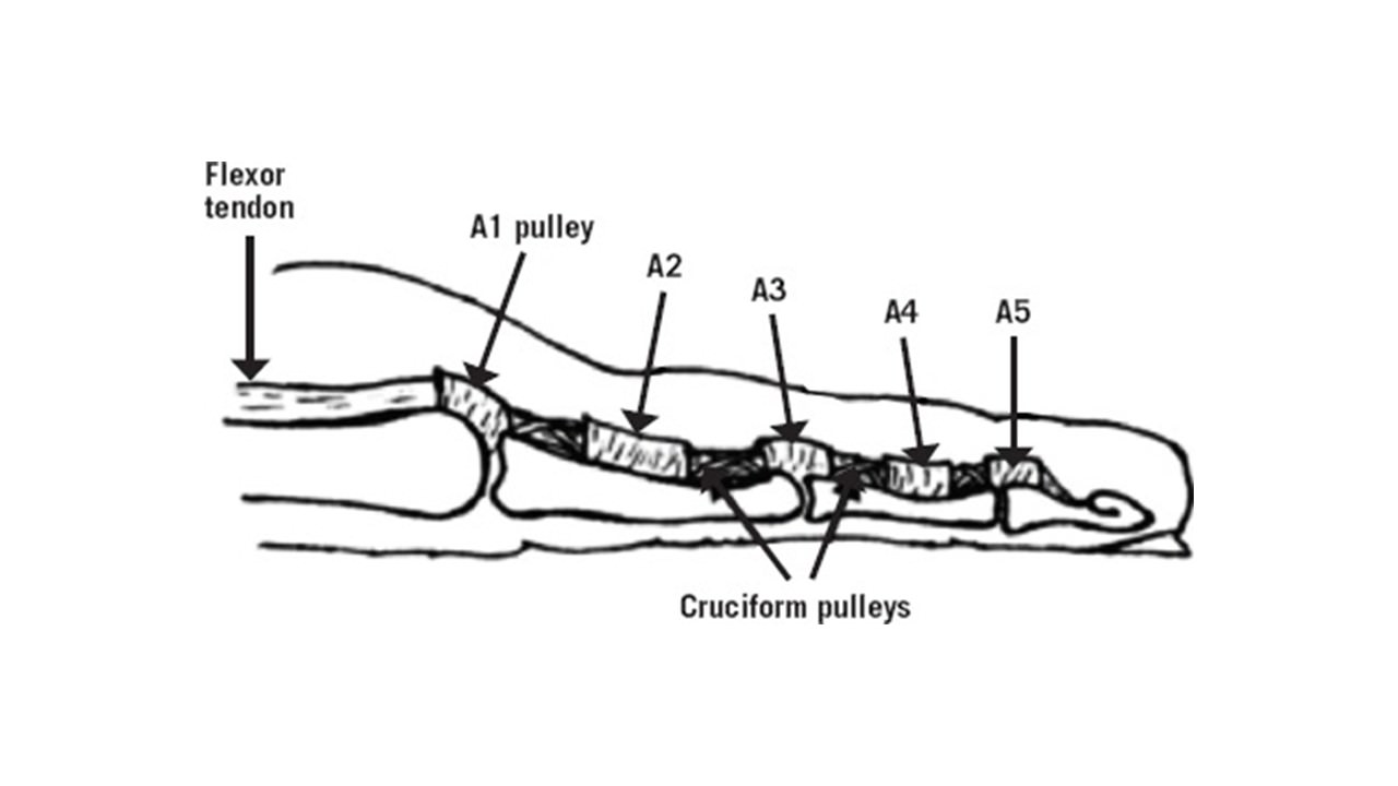 （圖二）腱鞘