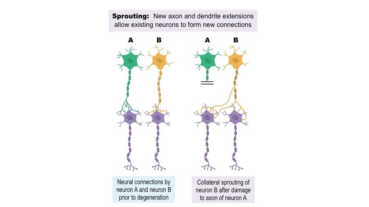神經可塑性的機制二-其他神經元新生突觸建立新連結，以取代斷路